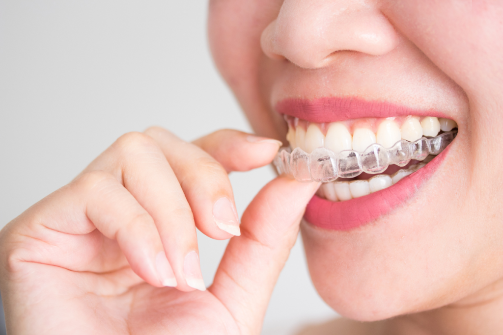 Orthodontist vs. Dentist: Making the Right Choice for Your Orthodontic Needs