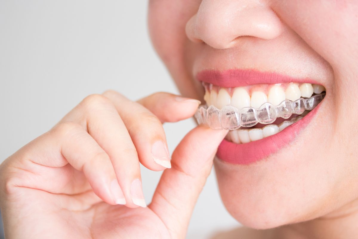 Orthodontist Vs Dentist Making The Right Choice For Your Orthodontic