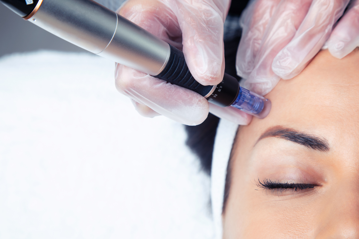 facial aesthetics near st albans