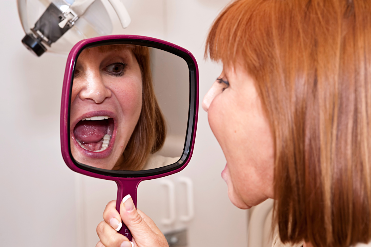 dental implants near st albans