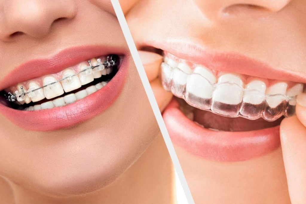 Will Orthodontic Treatment Be Painful? What to Expect During Adjustment