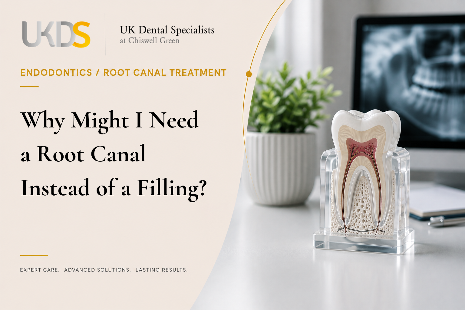 Why is a filling sometimes not enough? Learn when tooth decay or damage reaches the pulp and why root canal treatment may be needed to save the tooth.