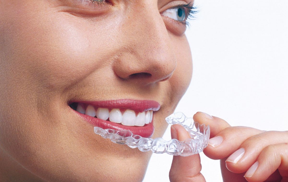 Invisalign in St Albans