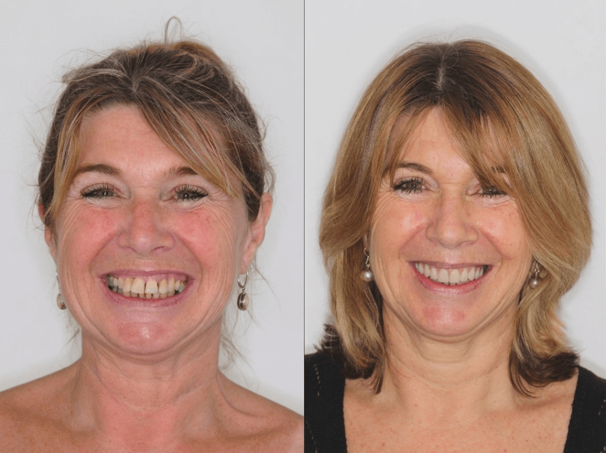 Dental Implants at UK Dental Specialists Banner